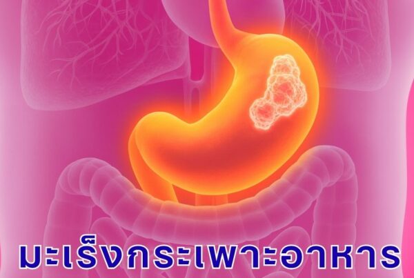มะเร็งกระเพาะอาหาร